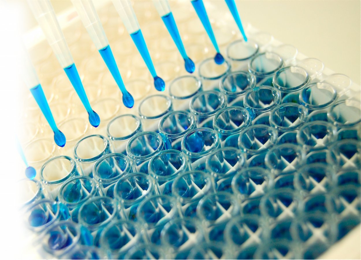 Human Leptin ELISA Kit